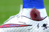 Neymar’s ankle left bloodied after Gimenez tackle